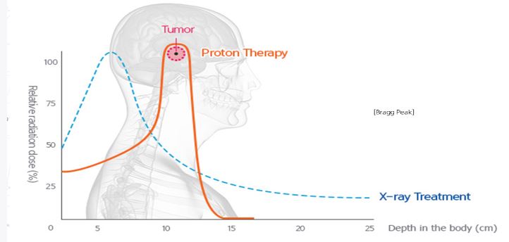 Proton Therapy Center of Samsung Medical Center
